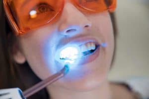 laser dental